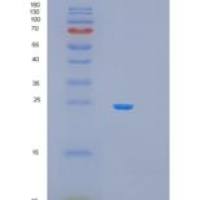 人线粒体核糖体蛋白S23(MRPS23)重组蛋白