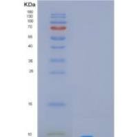 人金属硫蛋白3(MT3)重组蛋白