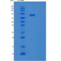 人基质金属蛋白酶2(MMP2)重组蛋白