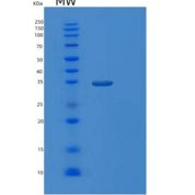 人大肠杆菌mdh重组蛋白