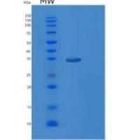 人大肠杆菌mdh重组蛋白