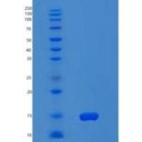 人黏病毒耐药蛋白2(MX2)重组蛋白