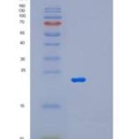 人微纤丝关联蛋白2(MFAP2)重组蛋白