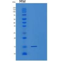 人Midkine重组蛋白