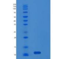 人基质Gla蛋白(MGP)重组蛋白