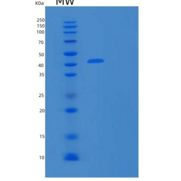 人基质金属蛋白酶8(MMP8)重组蛋白