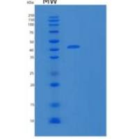 人基质金属蛋白酶8(MMP8)重组蛋白