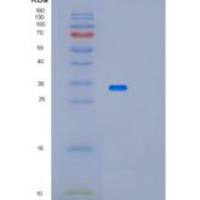 人METTL1重组蛋白