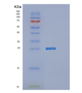人MTHFS重组蛋白
