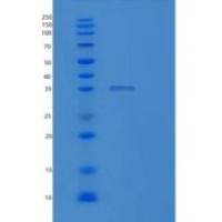 人线粒体核糖体蛋白S2(MRPS2)重组蛋白