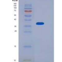 人MTHFD2重组蛋白