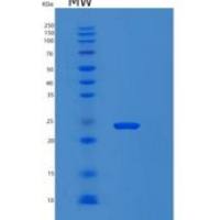 人肌球蛋白轻链4(MYL4)重组蛋白