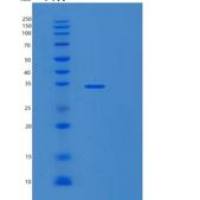 人MMACHC重组蛋白