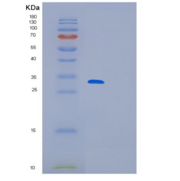 人RNA聚合酶II转录亚单位7(med 7)的介体重组蛋白