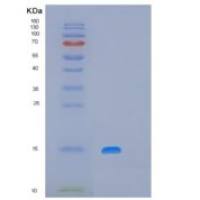 人线粒体核糖体蛋白S28(MRPS28)重组蛋白