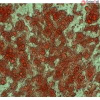 人前脂肪细胞-内脏 (Sciencell进口)