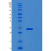 人肌球蛋白轻链12B(MYL12B)重组蛋白