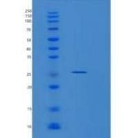 人MIS12重组蛋白