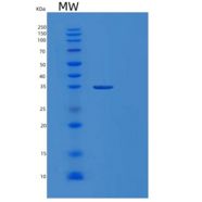 人苹果酸脱氢酶2(MDH2)重组蛋白