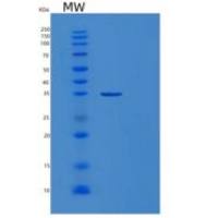人苹果酸脱氢酶2(MDH2)重组蛋白