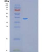人MED27重组蛋白