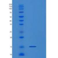 小鼠巨噬细胞移动抑制因子(MIF)重组蛋白