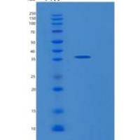 人MEMO1重组蛋白