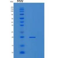 人肌球蛋白轻链2(MYL2)重组蛋白