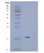 人微纤丝关联蛋白3(MFAP3)重组蛋白