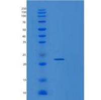 大鼠金属蛋白酶抑制剂1重组蛋白