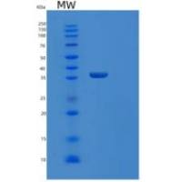 人苹果酸脱氢酶1(MDH1)重组蛋白
