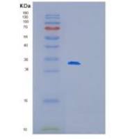 人RNA聚合酶II转录亚单位7（med 7）的介体重组蛋白