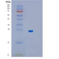 人MUTED重组蛋白