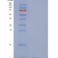 人MUCL1重组蛋白