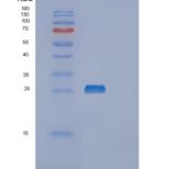 大肠杆菌甲硫氨酸亚砜还原酶A(MSRA)重组蛋白