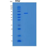 人基质金属蛋白酶14(MMP14)重组蛋白