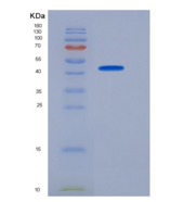 小鼠粒细胞巨噬细胞集落刺激因子2重组蛋白