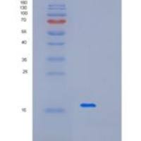 人微纤丝关联蛋白3(MFAP3)重组蛋白
