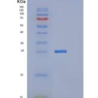 人MTHFS重组蛋白