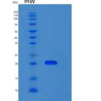 人肌球蛋白轻链12A(MYL12A)重组蛋白
