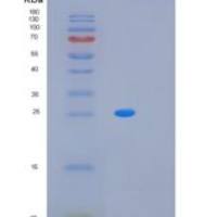 人MRGBP重组蛋白