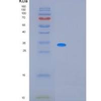 人线粒体核糖体蛋白L1(MRPL1)重组蛋白
