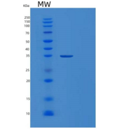 人苹果酸脱氢酶2(MDH2)重组蛋白