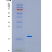人METTL21A重组蛋白