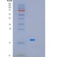 人METTL21A重组蛋白