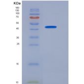 小鼠粒细胞巨噬细胞集落刺激因子2重组蛋白