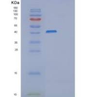 人巨噬细胞清道夫受体1(MSR1)重组蛋白