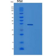 人Ⅰ类MHC多肽相关序列A(MICA)重组蛋白