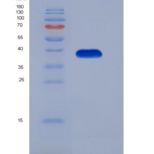 人基质金属蛋白酶23B(MMP23B)重组蛋白