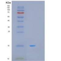 人MTCP1重组蛋白